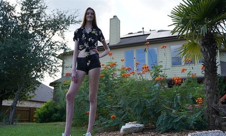 صاحبة أطول ساقين في العالم تدخل جينيس ـ فيديو ـ